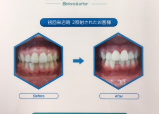 ホワイトニング　１.jpegのサムネール画像